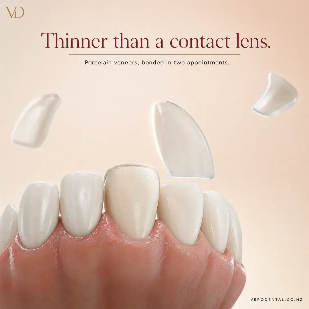 Withdrawn concept advertisement for Vero Dental, an invented clinic. Held back for: unsourced claim, outcome claim.